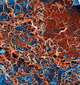 Ebola scanning electron image